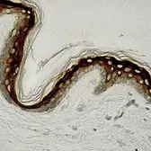 Anti-Involucrin antibody [SY5] used in IHC (Paraffin sections) (IHC-P). GTX72415